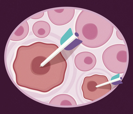 A graphic showing arrows hitting red cancer cells but not pink healthy cells.