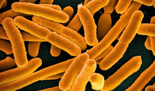 Microscope image showing E. coli.