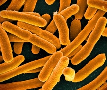 Microscope image showing E. coli.