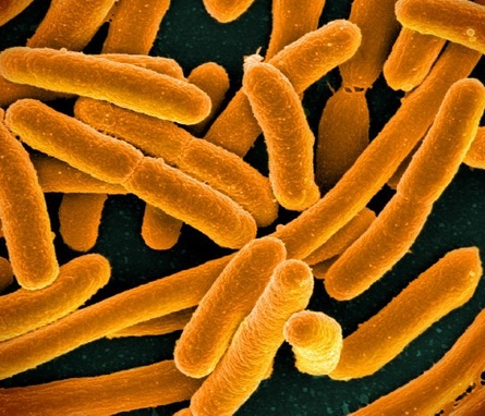 Microscope image showing E. coli.