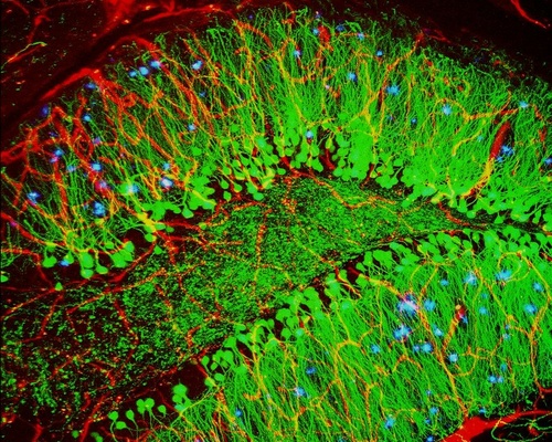 Microscopy image showing mouse brain with nerve cells, blood vessels, and plaques from Alzheimer's disease.