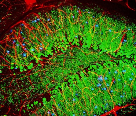 Microscopy image showing mouse brain with nerve cells, blood vessels, and plaques from Alzheimer's disease.