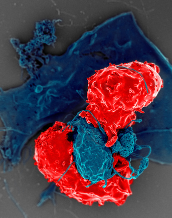 T Regulatory Cells. Scanning electron microscope image of T regulatory cells (red) interacting with antigen-presenting cells (blue). T regulatory cells can suppress responses by T cells to maintain homeostasis in the immune system.
