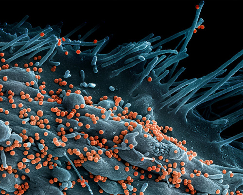 Microscope image showing Lassa virus budding off a cell.