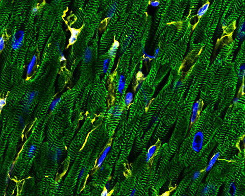 The human heart has a diversity of cell types, including cardiomyocytes (green) and fibroblasts (yellow). DNA is stained blue.