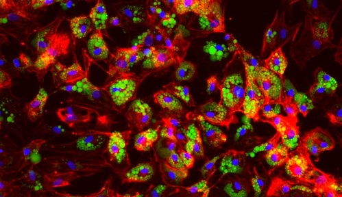 Color fluorescence microscope image of fat cells, aka adipocytes, with functional COBLL1. The cytoskeleton is dyed red, lipids are dyed green, cell nuclei are dyed blue. Many green fat deposits are visible.
