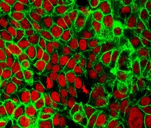 A microscope image of human colon cancer cells on a black background. The nuclei of the cells are stained red, and the protein E-cadherin is stained green.