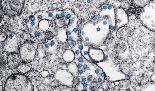 SARS-CoV-2 viral particles (blue) in a clinical isolate. (Credit: <a href=detailsc7af-3.html target="_blank">CDC</a>)