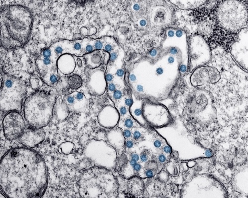 SARS-CoV-2 viral particles (blue) in a clinical isolate. (Credit: <a href=detailsc7af.html target="_blank">CDC</a>)