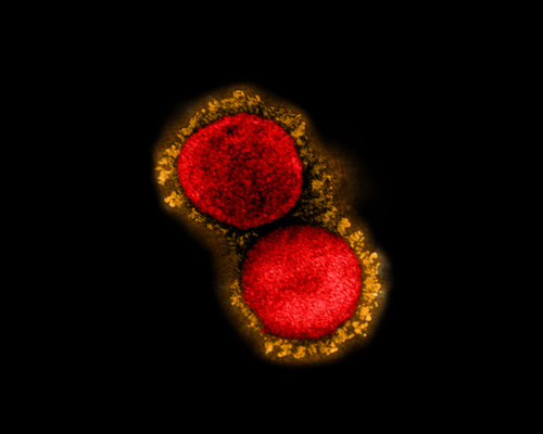 SARS-CoV-2 viral particles. (Credit: <a href=2kgqpvv_.html target="_blank">NIAID</a>)