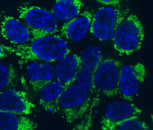 An image of human cells labeled for the frataxin protein (in green), which is insufficient in patients with Friedreich’s Ataxia.