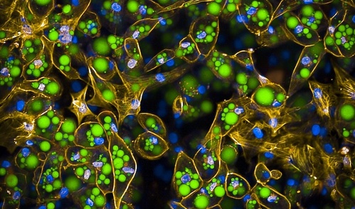 Color fluorescence microscope image of fat cells, aka adipocytes, with functional COBLL1. The cytoskeleton is dyed yellow, lipids are dyed green, cell nuclei are dyed blue. Many green fat deposits are visible.