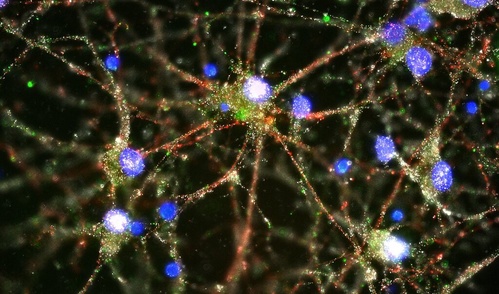 This image shows human neurons (in blue), with the C4 protein (in green) deposited on synapses. 