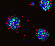 Spheroids grown from a high-grade glioma patient-derived cell line