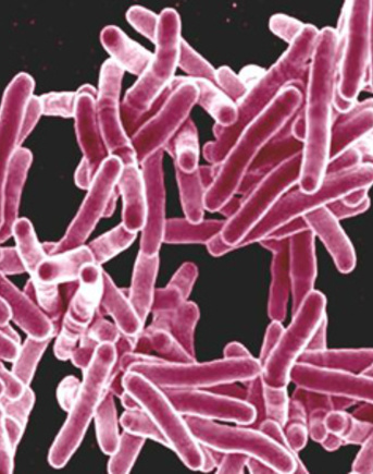 Scanning electron micrograph of Mycobacterium tuberculosis bacteria, which cause TB.