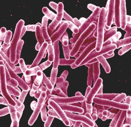 Scanning electron micrograph of Mycobacterium tuberculosis bacteria, which cause TB.