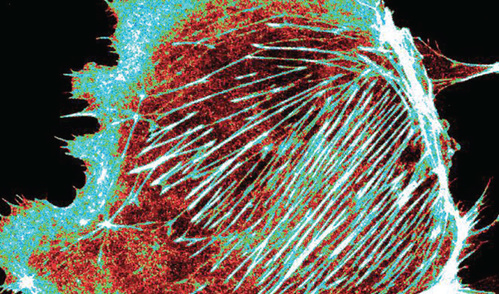 Pseudocolored image of a cultured mouse kidney podocyte.