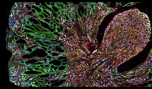 Misfolded MUC1-fs protein (green) builds up in the kidneys of a mouse model of <em>MUC1</em> kidney disease. (Credit: <a href=s0092-8674(19)30741-x_-3.html target="_blank">Dvela-Levitt M, et al.</a> <em>Cell</em>. 2019.)