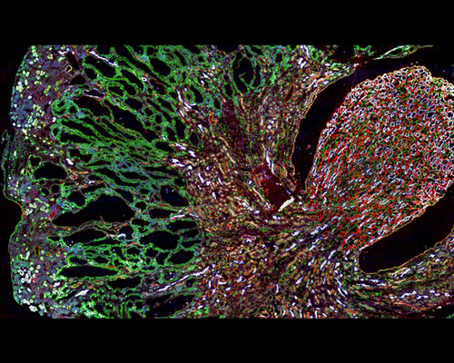 Misfolded MUC1-fs protein (green) builds up in the kidneys of a mouse model of <em>MUC1</em> kidney disease. (Credit: <a href=s0092-8674(19)30741-x_.html target="_blank">Dvela-Levitt M, et al.</a> <em>Cell</em>. 2019.)
