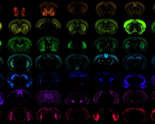 Array of microscopy images showing mouse brain tissue, each with different brain regions in different colors.