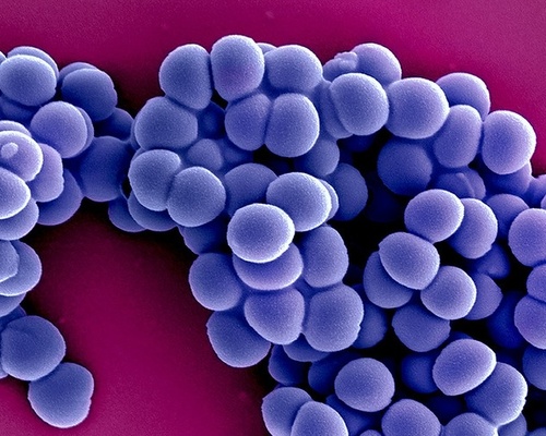 An electron microscope image of methicillin-resistant Staphylococcus aureus, also called MRSA.