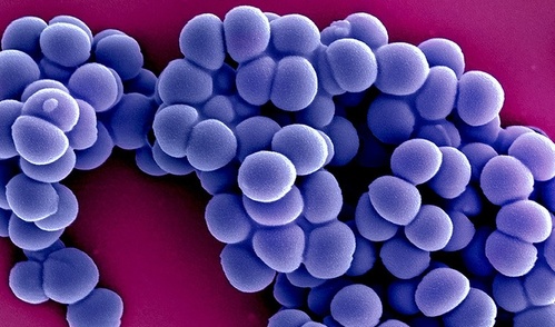 An electron microscope image of methicillin-resistant Staphylococcus aureus, also called MRSA.