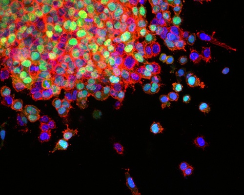 Microscopy image of lung cancer cells shown in bright colors (blue and green)