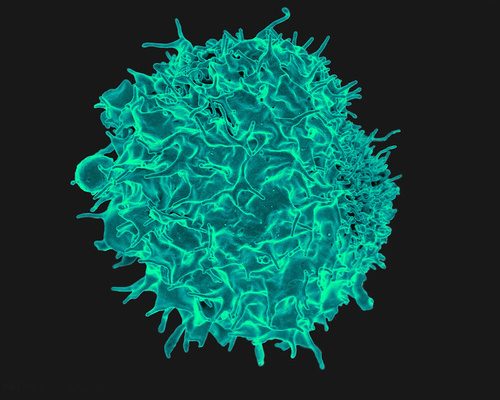 Micrograph of a T cell, an immune cell type often implicated in autoimmune disorders.