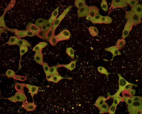 Fluorescence microscopy image of beta cells treated with a special dye to show increased membrane rigidity when exposed to a toxic free fatty acid.