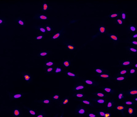 Microscopy image showing chromatin in cells as pink and purple blobs.