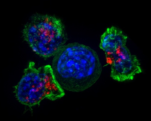 A fluorescent microscope image of three T cells, colored green and red, surrounding a cancer cell, colored blue.
