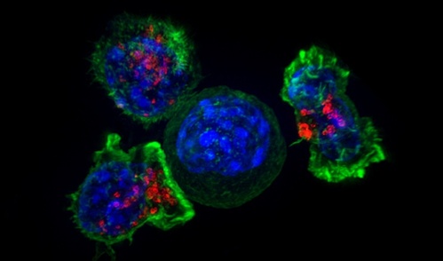 A fluorescent microscope image of three T cells, colored green and red, surrounding a cancer cell, colored blue.