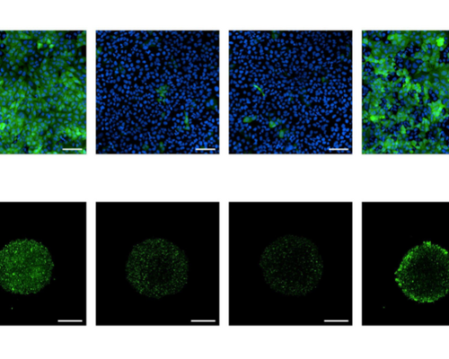 A set of fluorescent microscopy images depicting green and blue cells, showing the effects of inhibiting CRISPR-Cas9 using anti-CRISPR proteins delivered with LFN-Acr/PA.
