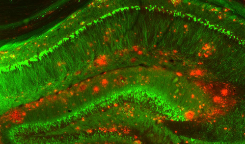A fluorescence microscopy image showing buildup of amyloid beta clusters among neurons in a mouse model of Alzheimer’s disease.