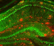 A fluorescence microscopy image showing buildup of amyloid beta clusters among neurons in a mouse model of Alzheimer’s disease.