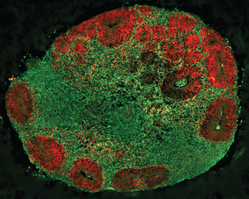 Color microscope image of a brain chimeroid, with red and green colors highlighting different types of cells and different structures.