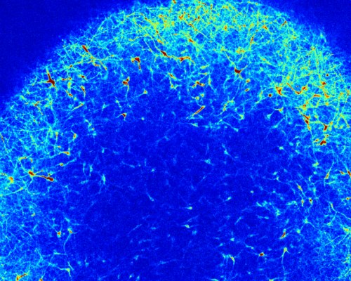 Microscopy image of a brain organoid showing individual neurons spontaneously firing