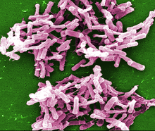 Researchers found that a compound made by intestinal microbes in centenarians strongly inhibits the growth of Clostridium difficile (colorized), which causes severe diarrhea and gut inflammation.