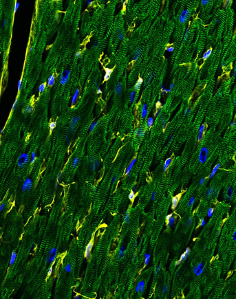 The human heart has a diversity of cell types, including cardiomyocytes (green) and fibroblasts (yellow). DNA is stained blue.