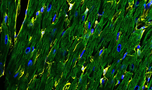 The human heart has a diversity of cell types, including cardiomyocytes (green) and fibroblasts (yellow). DNA is stained blue.