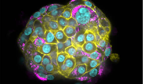 An intact pancreatic islet treated with interferon alpha and gamma, and stained for HLA-1 (yellow), proinsulin (magenta), nuclei (cyan).