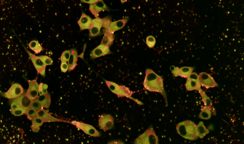 Microscopy image of pancreatic beta cells with some outlined in red, indicating increased membrane rigidity.