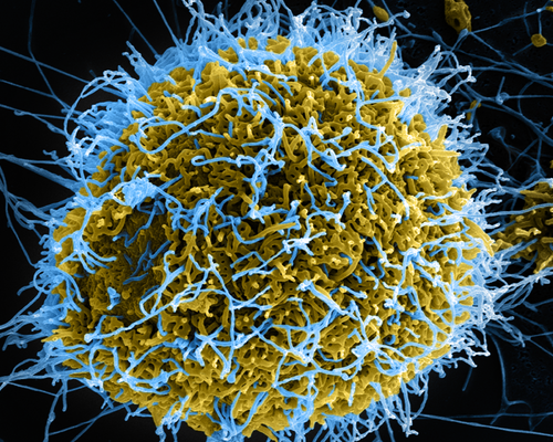 A scanning electron microscope captured Ebola virus particles (colored in blue) budding from a chronically infected VERO E6 cell (colored in yellow-green).
