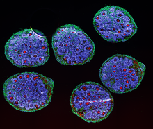 Human brain organoids showing neurons and their dendrites (green), telencephalic (forebrain) cells (blue), and a kind of cell-cell contact called tight junctions (red).