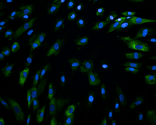 Collagen (green) and cell nuclei (blue) in fibroblasts with knockdown of the gene RNF168, which affects collagen production.