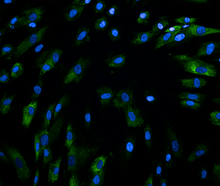 Collagen (green) and cell nuclei (blue) in fibroblasts with knockdown of the gene RNF168, which affects collagen production.