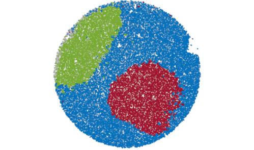 An image of how slide-DNA-seq "sees" cells' organization within a tumor.