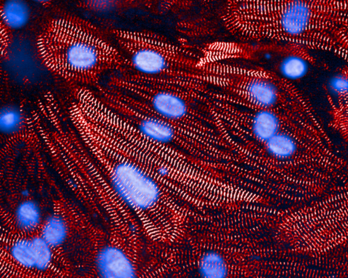 A microscope image of heart muscle cells, with contraction-related proteins stained red and cell nuclei stained blue.