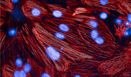 A microscope image of heart muscle cells, with contraction-related proteins stained red and cell nuclei stained blue.