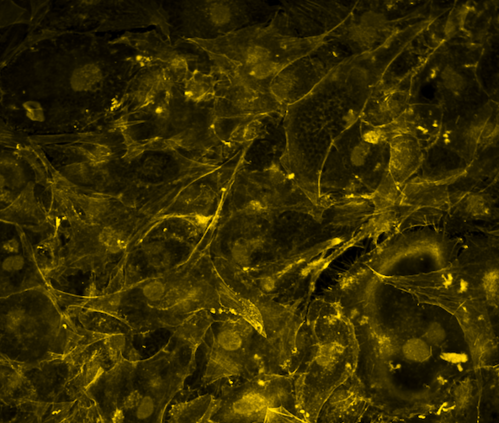 Actin, plasma membrane, and golgi 